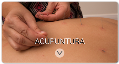 acupuncture_1-satori_vitae