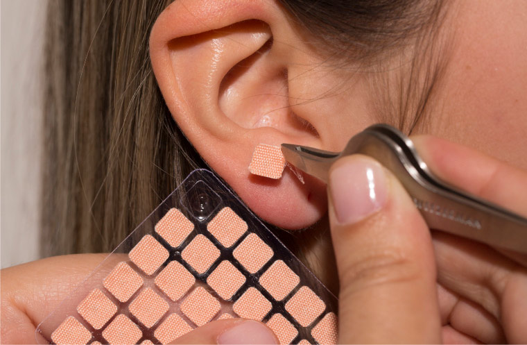 therapies_auriculoterapia_auricular_therapy_satorivitae