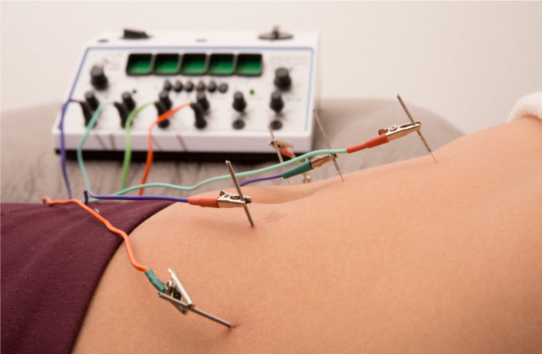 therapies_e_stim_electroacupuntura_satorivitae