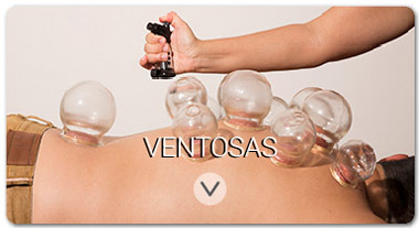 treatments_cupping__satori_vitae-es